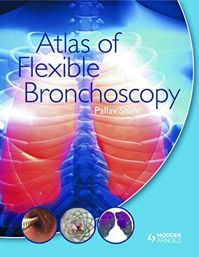 9780340968321: Atlas of Flexible Bronchoscopy