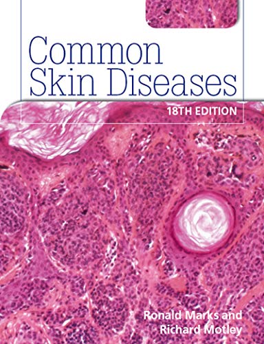 Stock image for Common Skin Diseases 18th Edition for sale by Better World Books Ltd