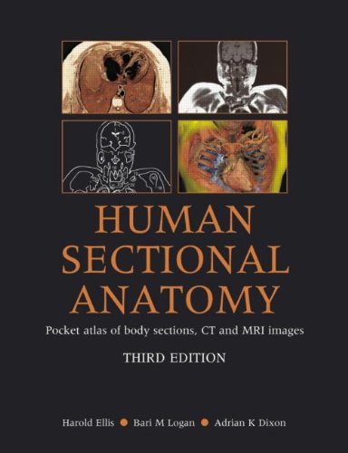 9780340985168: Human Sectional Anatomy: Pocket Atlas of Body Sections, CT and MRI Images, Third Edition