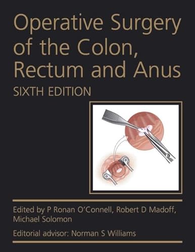 9780340991275: Operative Surgery of the Colon, Rectum and Anus