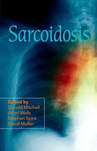 9780340992111: Sarcoidosis