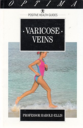 Beispielbild fr Varicose Veins: How They are Treated and What You Can Do to Help (Positive Health Guide) zum Verkauf von AwesomeBooks