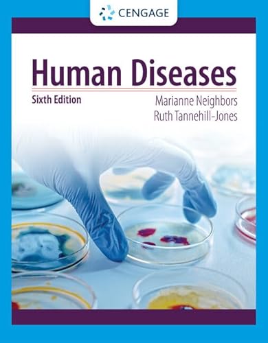 9780357618042: Human Diseases (Mindtap Course List)