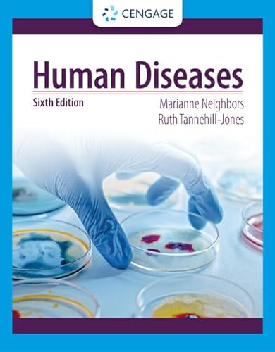 9780357618042: Human Diseases (MindTap Course List)