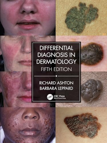 Imagen de archivo de Differential Diagnosis in Dermatology a la venta por Chiron Media