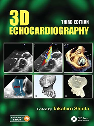 Beispielbild fr 3D Echocardiography 3Ed (Hb 2021) zum Verkauf von Basi6 International