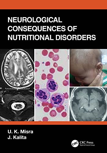 Stock image for Neurological Consequences of Nutritional Disorders for sale by Books Puddle