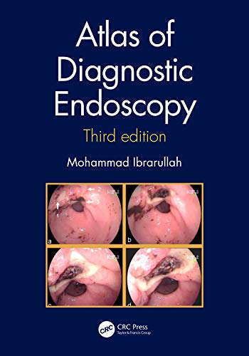 9780367345006: Atlas of Diagnostic Endoscopy, 3E