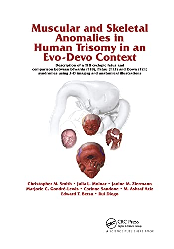 Stock image for Muscular and Skeletal Anomalies in Human Trisomy in an Evo-Devo Context: Description of a T18 Cyclopic Fetus and Comparison Between Edwards (T18), . 3-D Imaging and Anatomical Illustrations for sale by Lucky's Textbooks