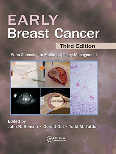 9780367380465: Early Breast Cancer: From Screening to Multidisciplinary Management, Third Edition