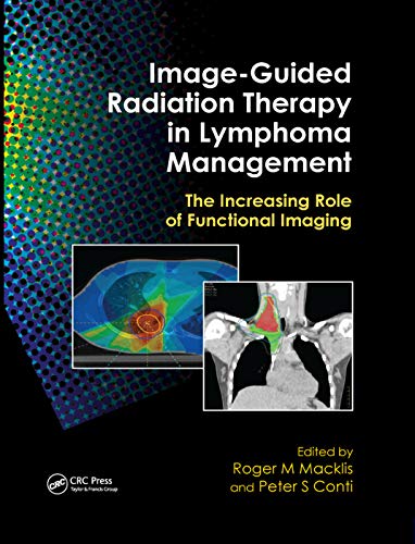 Stock image for Image-Guided Radiation Therapy in Lymphoma Management: The Increasing Role of Functional Imaging for sale by ThriftBooks-Dallas