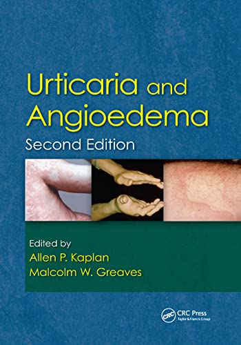 Beispielbild fr Urticaria and Angioedema zum Verkauf von Blackwell's