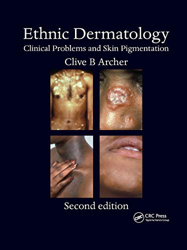 Beispielbild fr Ethnic Dermatology zum Verkauf von Blackwell's