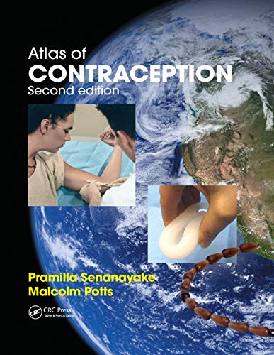 Imagen de archivo de Atlas of Contraception a la venta por Blackwell's