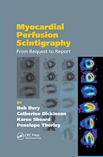 9780367387853: Myocardial Perfusion Scintigraphy: From Request to Report