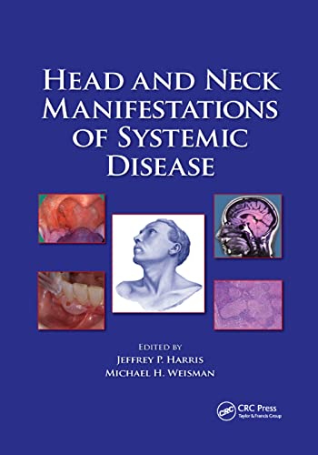 Beispielbild fr Head and Neck Manifestations of Systemic Disease zum Verkauf von Blackwell's