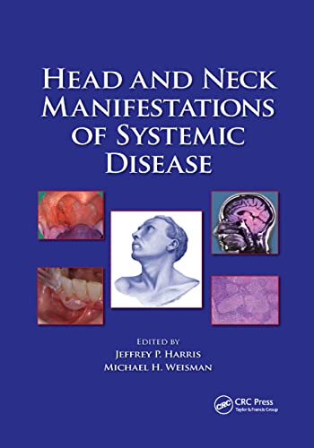 Imagen de archivo de Head and Neck Manifestations of Systemic Disease a la venta por Blackwell's