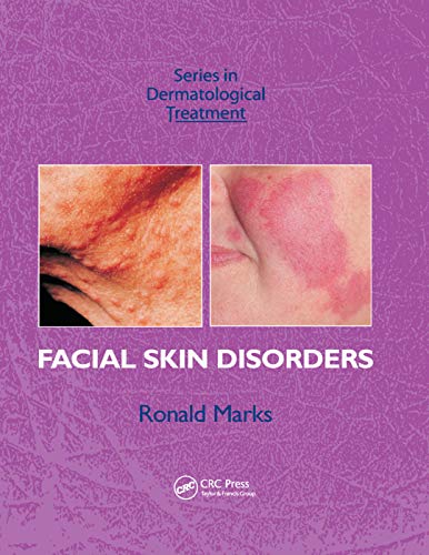 9780367389390: Facial Skin Disorders (Series in Dermatological Treatment)