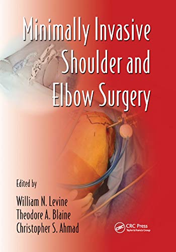 Beispielbild fr Minimally Invasive Shoulder and Elbow Surgery zum Verkauf von Blackwell's