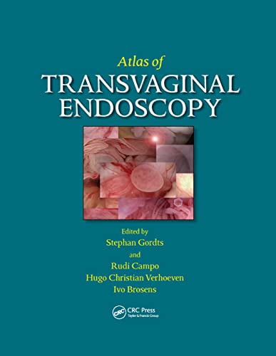 Beispielbild fr Atlas of Transvaginal Endoscopy zum Verkauf von Blackwell's