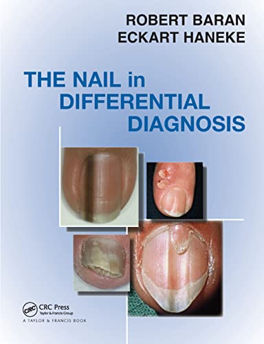 Stock image for Nail in Differential Diagnosis for sale by Revaluation Books