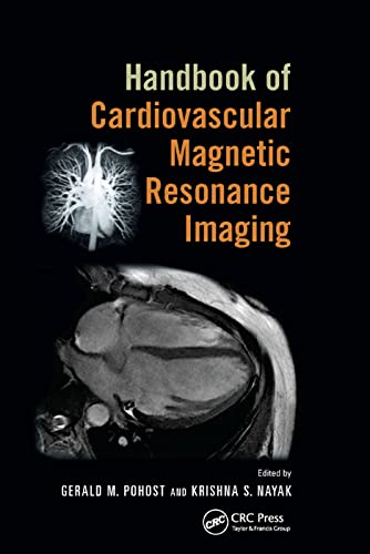 Imagen de archivo de Handbook of Cardiovascular Magnetic Resonance Imaging a la venta por Blackwell's