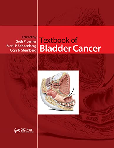 Stock image for Textbook of Bladder Cancer for sale by Blackwell's
