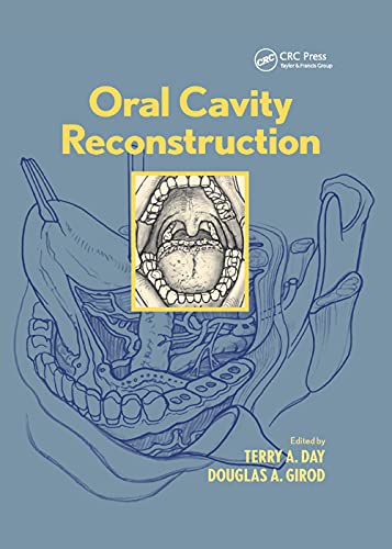 Beispielbild fr Oral Cavity Reconstruction zum Verkauf von Blackwell's