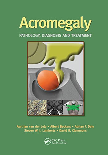 Imagen de archivo de Acromegaly: Pathology, Diagnosis and Treatment a la venta por Lucky's Textbooks