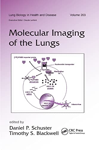Stock image for MOLECULAR IMAGING OF THE LUNGS LUNG BIOLOGY IN HEALTH AND DISEASE VOLUME 203 (PB 2019) for sale by Basi6 International