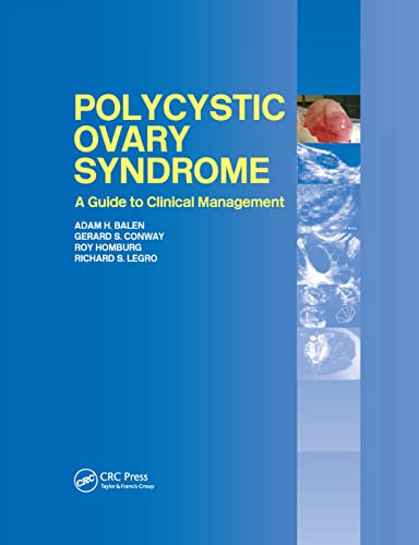 Stock image for Polycystic Ovary Syndrome: A Guide to Clinical Management for sale by Inspire Trading