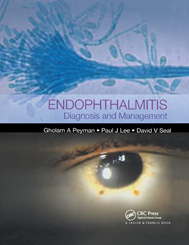 Stock image for Endophthalmitis for sale by Blackwell's