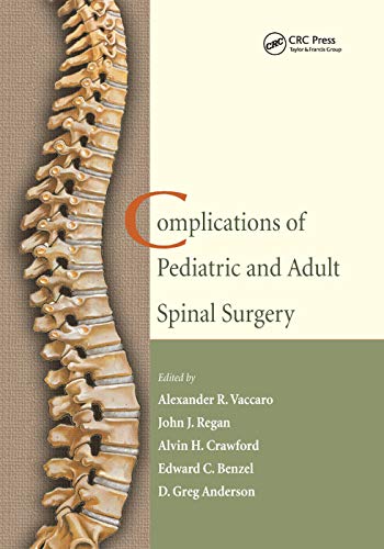 Beispielbild fr Complications of Pediatric and Adult Spinal Surgery zum Verkauf von Lucky's Textbooks