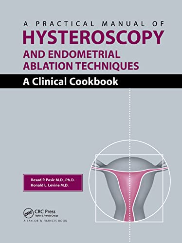 Stock image for A Practical Manual of Hysteroscopy and Endometrial Ablation Techniques: A Clinical Cookbook for sale by Revaluation Books