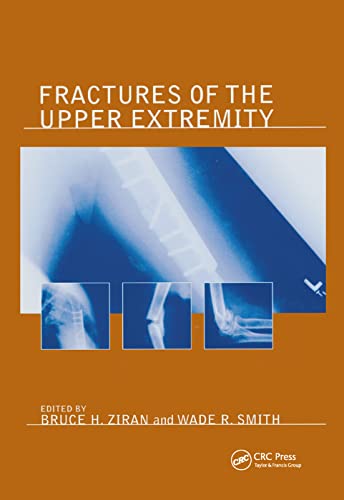 Beispielbild fr Fractures of the Upper Extremity zum Verkauf von Blackwell's