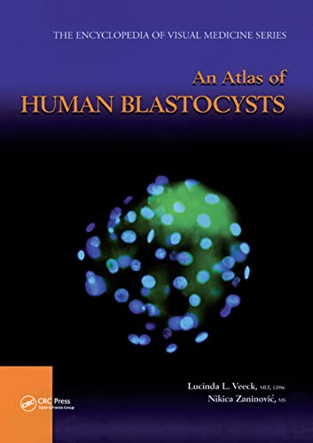 Imagen de archivo de An Atlas of Human Blastocysts a la venta por THE SAINT BOOKSTORE