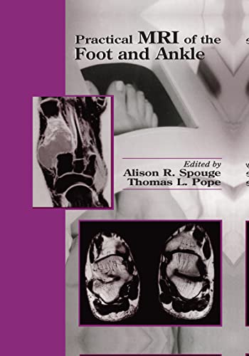 9780367398156: Practical MRI of the Foot and Ankle