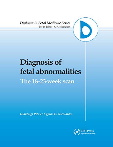 Beispielbild fr Diagnosis of Fetal Abnormalities zum Verkauf von Blackwell's