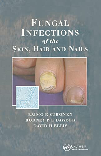 Stock image for Fungal Infections of the Skin, Hair and Nails for sale by Revaluation Books