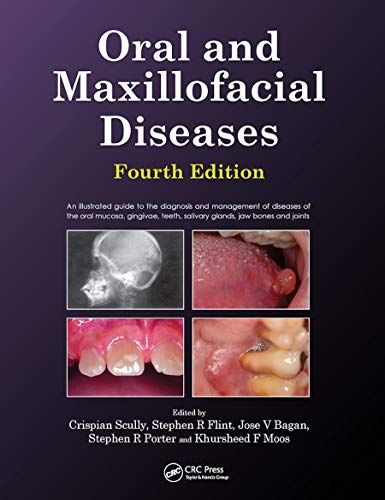 Beispielbild fr Oral and Maxillofacial Diseases, Fourth Edition zum Verkauf von Blackwell's