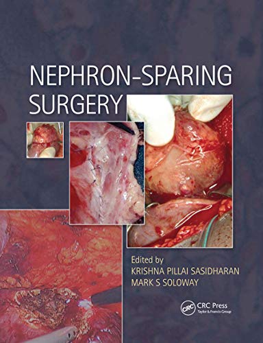 Beispielbild fr Nephron-Sparing Surgery zum Verkauf von Blackwell's