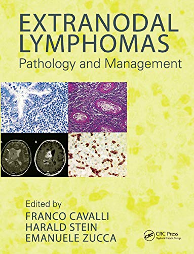 Stock image for Extranodal Lymphomas for sale by Blackwell's