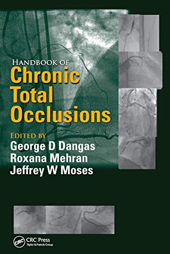 Imagen de archivo de Handbook of Chronic Total Occlusions a la venta por Blackwell's