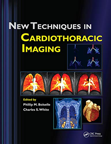 Stock image for New Techniques in Cardiothoracic Imaging for sale by Blackwell's