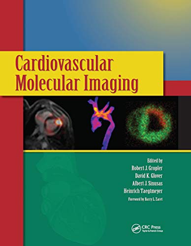 Imagen de archivo de Cardiovascular Molecular Imaging a la venta por Blackwell's