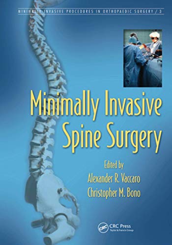 Imagen de archivo de Minimally Invasive Spine Surgery a la venta por Blackwell's