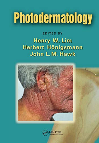 Stock image for Photodermatology for sale by Blackwell's