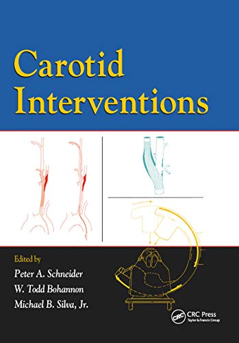 Beispielbild fr Carotid Interventions zum Verkauf von Blackwell's