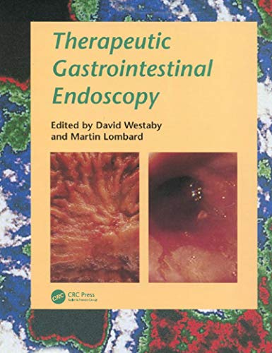 Beispielbild fr Therapeutic Gastrointestinal Endoscopy zum Verkauf von Blackwell's