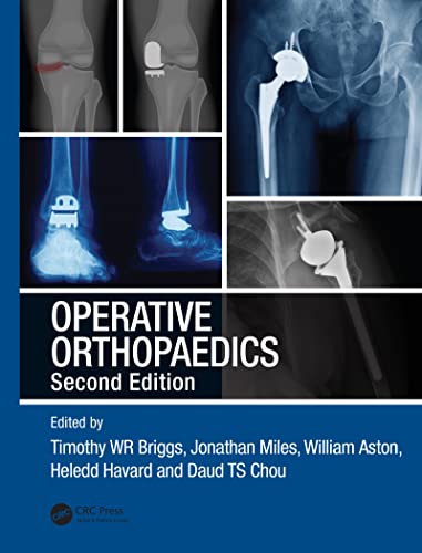 Stock image for Operative Orthopaedics for sale by Basi6 International